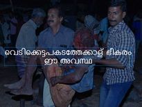 വെടിക്കെട്ടപകടത്തേക്കാള്‍ ഭീകരം ഈ അവസ്ഥ