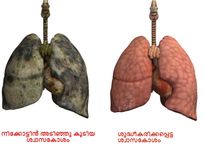 ശ്വാസകോശം ക്ലീന്‍ ചെയ്യാന്‍ ഈ ഭക്ഷണങ്ങള്‍