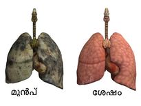 ശ്വാസകോശം ക്ലീനാക്കാം മൂന്ന് ദിവസം കൊണ്ട്