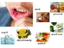 തുടക്കം ഇങ്ങനെ, എന്നാല്‍ മാറാനുള്ള ബുദ്ധിമുട്ട്