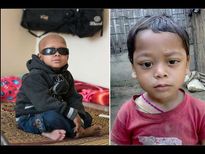 ഈ കുഞ്ഞിന്റെ കണ്ണില്‍ കണ്ണീരിനു പകരം രക്തം