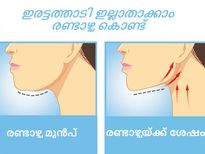 ഇരട്ടത്താടിയ്ക്ക് രണ്ടാഴ്ച കൊണ്ട് പരിഹാരം 