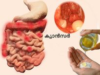 ബേക്കിംഗ്‌സോഡ, തേന്‍, ആയുസ്സിന്റെ ഒറ്റമൂലി