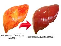 കരള്‍ സുരക്ഷിതമാക്കാന്‍ ഈ ഭക്ഷണങ്ങള്‍
