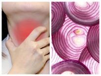 സവാള കഴുത്തില്‍ കെട്ടി തൈറോയ്ഡ് പരിഹാരം