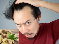 കഷണ്ടിയില്‍ മുടി വരാന്‍ ഇഞ്ചി വിദ്യ