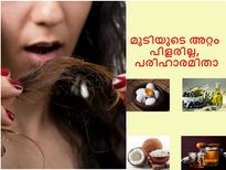  മുടിയുടെ അറ്റം പിളരില്ല, ഉറപ്പ് നല്‍കും മാര്‍ഗ്ഗം