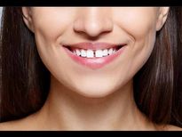 പെണ്ണിന്റെ മുന്‍നിരയിലെ പല്ലില്‍ വിടവോ, ഇത് ഭാഗ്യം