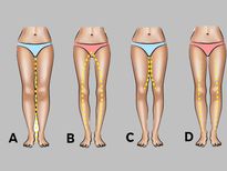 പെണ്ണിന്റെ മിടുക്കറിയാം കാലിന്റെ വിടവ് നോക്കി