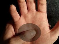 ഉള്ളംകയ്യില്‍ അല്‍പനേരം അമര്‍ത്തൂ, കാരണം