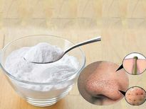 1സ്പൂണ്‍ ബേക്കിംഗ്‌സോഡ ബ്ലാക്ക്‌ഹെഡ്‌സ് ക്ലീന്‍