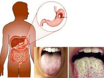 ശരീരത്തില്‍പതുക്കെ ക്യാന്‍സര്‍ വളരുന്നോ,നാവ് പറയും