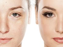  പഴത്തിന്റെ തോലിലുണ്ട് പ്രായം കുറക്കും ഒറ്റമൂലി