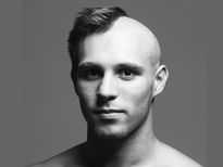 കഷണ്ടിയ്ക്കു പരിഹാരം പ്രത്യേക സവാളക്കൂട്ട്‌