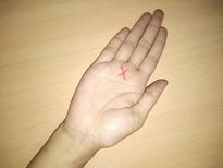 ആണിന് നടുവിരലിന് നടുവില്‍ X ഉണ്ടോ?