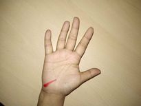 സന്താനലബ്ധിക്ക് തടസ്സം നില്‍ക്കുന്ന ആ രേഖ ഇതാണ്