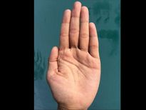 പെണ്ണിന്‍റെ ഇടത്ത് കൈരേഖയിലാണ് നിർഭാഗ്യം 