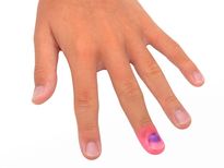 നഖത്തിനടിയില്‍ നീല നിറമെങ്കില്‍ സൂചനയാണ്,....