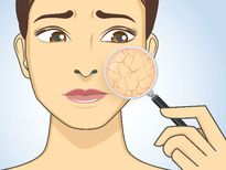 ശരീരത്തിനല്ല, ചര്‍മ്മത്തില്‍ നിര്‍ജ്ജലീകരണമോ?