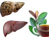 പേരയുടെ തളിരിലവെള്ളം കേടായ കരളിനെ കാക്കും