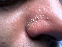 കാപ്പിപ്പൊടിയിൽ തീരാത്ത പ്രശ്നങ്ങളില്ല ചർമ്മത്തിൽ