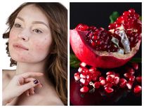 മാതളനാരങ്ങക്കുരുവും തൊലിയും നൽകും നിറം