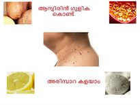 ആസ്പിരിനും ഇഞ്ചിയിലെ ചുണ്ണാമ്പും അരിമ്പാറ കളയും