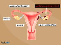 ആർത്തവത്തിന് തൊട്ടുമുൻപ് വയറുവേദന ഭയക്കേണ്ടതാണ്