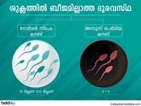ശുക്ലത്തിൽ ബീജമില്ലാത്തത് പുരുഷവന്ധ്യത വില്ലൻ
