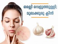 ഒരല്ലി വെളുത്തുള്ളി; മുഖക്കുരു ക്ലീന്‍
