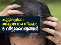 കുട്ടികളിലെ അകാല നര നീക്കാം; 5 വീട്ടുവൈദ്യങ്ങള്‍