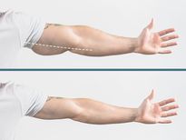 കൈയ്യിലെ കൊഴുപ്പിന് ദിനവും 30 സെക്കന്റ് വ്യായാമം