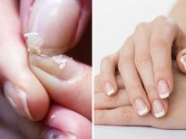 നഖം എത്ര പൊട്ടയാണെങ്കിലും ഇനി പേടിക്കണ്ട