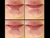 വെളുത്തുള്ളി റബ്ബര്‍ പോലെ മായ്ക്കും ഈ പ്രശ്‌നം