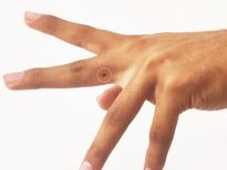 വിരലിലെ മറുക് പറയുന്ന ഭാഗ്യ നിര്‍ഭാഗ്യങ്ങള്‍