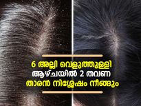 6 അല്ലി വെളുത്തുള്ളി; താരന്‍ നിശ്ശേഷം നീങ്ങും