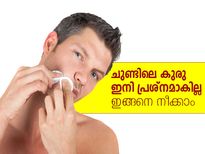 ചുണ്ടിലെ കുരു ഇനി പ്രശ്‌നമാകില്ല ഇങ്ങനെ നീക്കാം