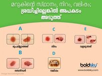 ഈ 5 തരത്തിലുള്ള മറുക് കണ്ടാല്‍ അല്‍പം ഭയക്കണം