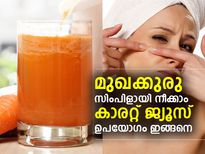മുഖക്കുരു നീക്കാന്‍ കാരറ്റ്; ഉപയോഗം ഇങ്ങനെ
