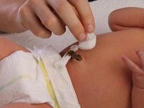 കുഞ്ഞിന് പൊക്കിളില്‍ അണുബാധയോ, പരിഹാരം