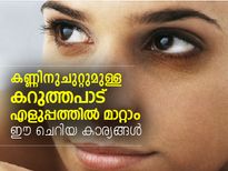 കണ്‍തടത്തിലെ കറുപ്പ് എളുപ്പത്തില്‍ മാറ്റാം