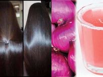 മുടി അങ്ങ് നീണ്ട് വരും സവാള നീര് ദിവസവുമെങ്കില്‍