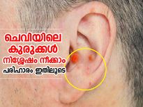 ചെവിയിലെ കുരുവിനെ നിശ്ശേഷം നീക്കാം; ഇത് പ്രയോഗിക്കൂ
