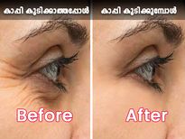 കാപ്പി കുടിക്കുന്നയാള്‍ അത് നിര്‍ത്തിയാല്‍ മാറ്റം ഇതെല്ലാം