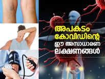 അപകടം കോവിഡിന്റെ ഈ അസാധാരണ ലക്ഷണങ്ങള്‍