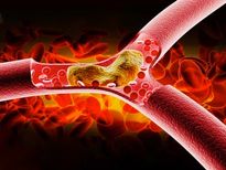 കൊളസ്‌ട്രോള്‍ പിടിച്ച് കെട്ടിയ പോലെ നിര്‍ത്തുമെന്ന് ഉറപ്പാണ്