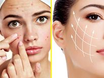 മുഖക്കുരു എളുപ്പത്തില്‍ അകറ്റാം; രണ്ടാഴ്ചത്തെ ഉപയോഗം