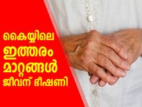 കൈയ്യിലെ ഈ മാറ്റങ്ങള്‍ അവഗണിക്കല്ലേ; ജീവന് ഭീഷണി