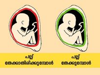  പല്ല് തേക്കുന്നത് പല്ലിന്റെ ആരോഗ്യത്തിന് മാത്രമല്ല; അറിയണം ഇതെല്ലാം