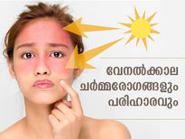 വേനല്‍ സമ്മാനിക്കും ഈ ചര്‍മ്മ പ്രശ്‌നങ്ങള്‍; ശ്രദ്ധിക്കണം